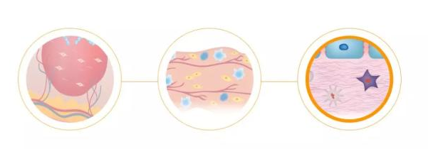 ▲Cytori公司的细胞疗法示意图（图片来源：Cytori公司官网）