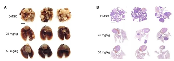 结肠癌小鼠的肺部癌细胞转移的图像