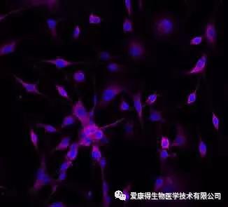 纳米体与结肠癌细胞结合的荧光显微镜图像